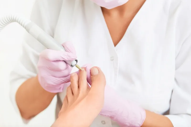 Bild zur Speziellen Nagelbehandlung
